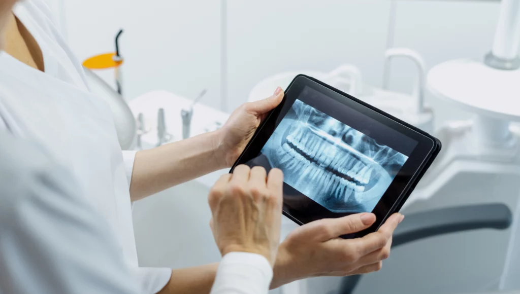 Digital X-ray at Hunters Point dentistry