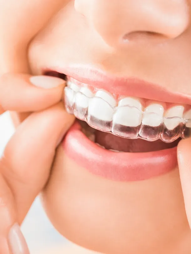 Invisalign | Your Dentist in Long Island City, NY