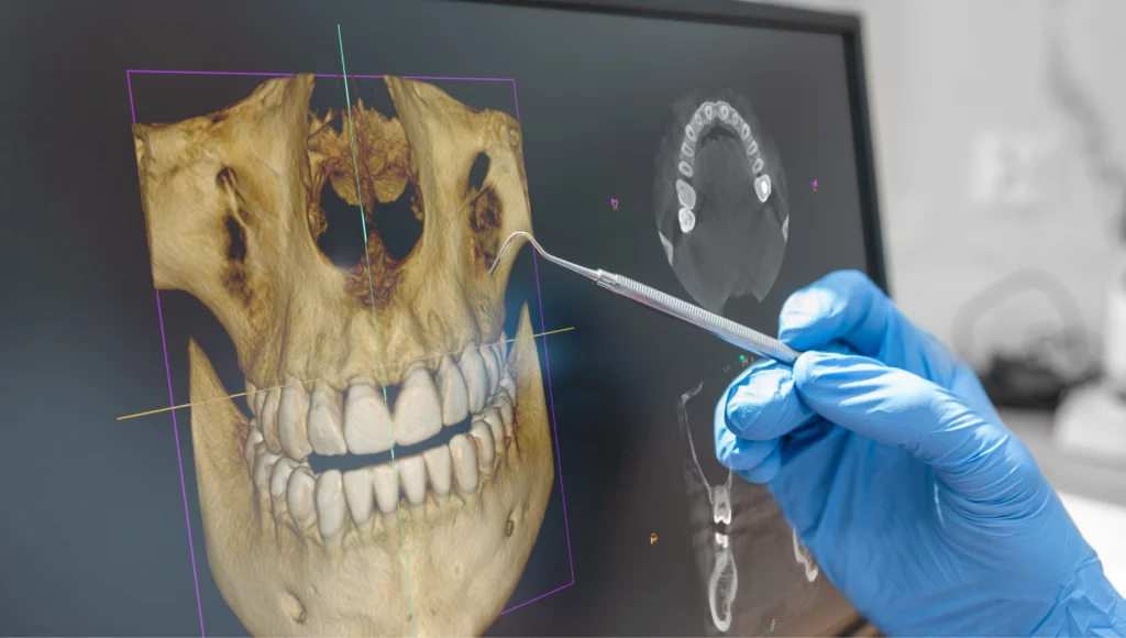 Digital CT scan at Hunters Point dentistry
